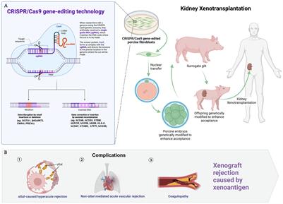 Advancing kidney xenotransplantation with anesthesia and surgery - bridging preclinical and clinical frontiers challenges and prospects